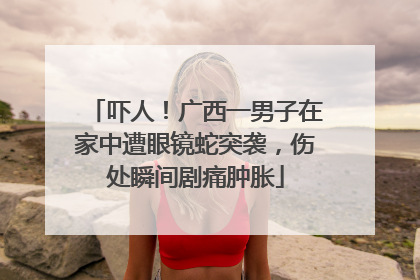 吓人！广西一男子在家中遭眼镜蛇突袭，伤处瞬间剧痛肿胀